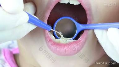 高清视频特写牙医清洁牙齿和<strong>检查</strong>与斑块去除工具